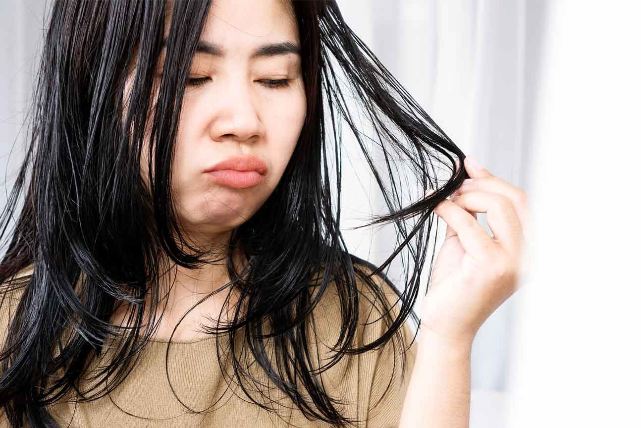 masalah rambut lepek